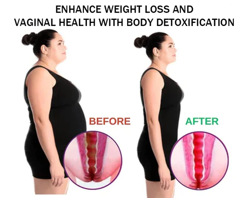 Dobshow™ Medical-Grade Gynecological Detox & Body Toning Gel 