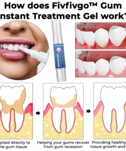 Dobshow™ Gum Instant Treatment Gel