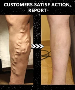 EXPECTSKY Tourmaline Ion Body Shaping Stretch Silk Stockings