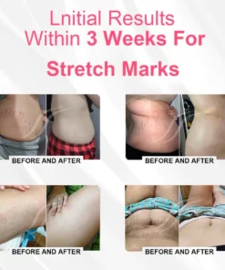 EXPECTSKY™ Negative Oxygen Ion Fat Burning Tummy Control & Detox Bodysuit