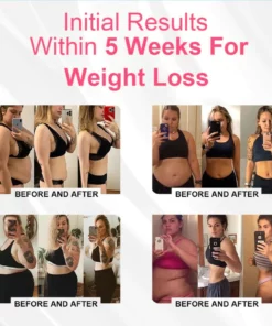 EXPECTSKY™ Negative Oxygen Ion Fat Burning Tummy Control & Detox Bodysuit