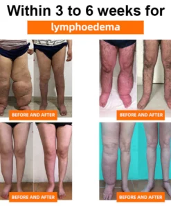 Eiceh® Radiofrequenz-Kräuter-Thermo-Kniepads