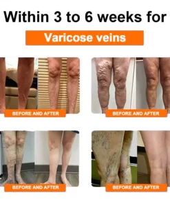 Eiceh® Radiofrequenz-Kräuter-Thermo-Kniepads