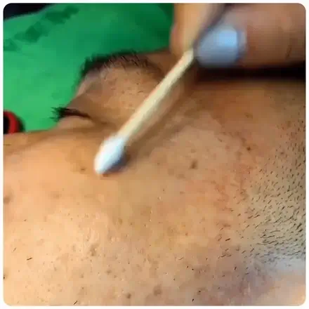 FCSKT™ Pigment Correcting Cream