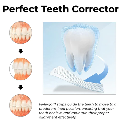 Fivfivgo™ Aligner-Streifen für Zähne