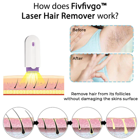 Fivfivgo™ Lazer-Haarentferner