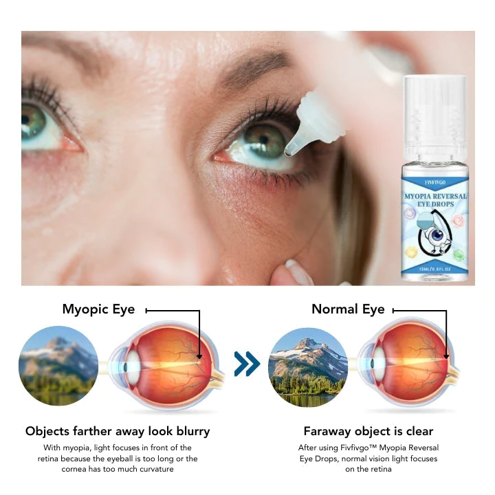 Fivfivgo™ Myopie Reversal Augentropfen