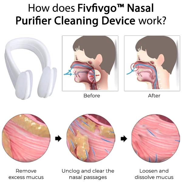 Fivfivgo™ Nasensauger-Reinigungsgerät