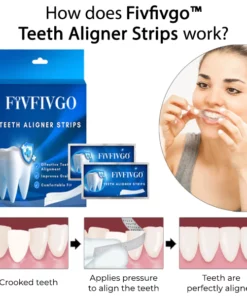 Fivfivgo™ Aligner-Streifen für Zähne