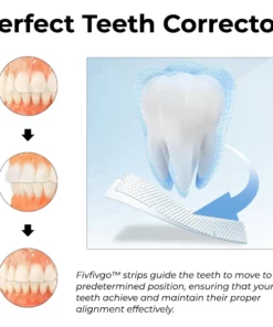 Fivfivgo™ Aligner-Streifen für Zähne