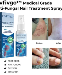 Fivfivgo™ Anti-Pilz-Nagelbehandlungsspray in medizinischer Qualität