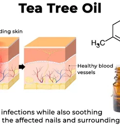 Fivfivgo™ Anti-Pilz-Nagelbehandlungsspray in medizinischer Qualität