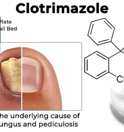Fivfivgo™ Anti-Pilz-Nagelbehandlungsspray in medizinischer Qualität