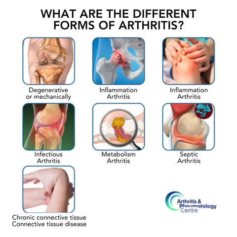 Fivfivgo™ ArthriBee Gelenk- und Knochentherapie-Creme