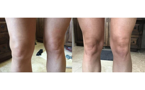 Fivfivgo™ ArthriBee Gelenk- und Knochentherapie-Creme