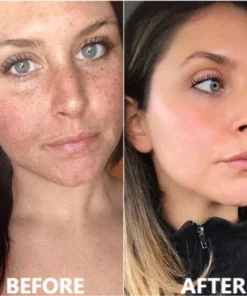 Fivfivgo™ Collagen Boost Anti-Aging-Serum zur Entfernung von 97 % tiefer Falten und dunkler Flecken