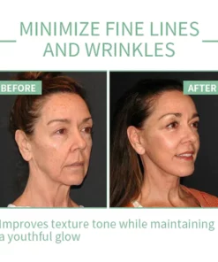 Fivfivgo™ Collagen Boost Anti-Aging-Serum zur Entfernung von 97 % tiefer Falten und dunkler Flecken