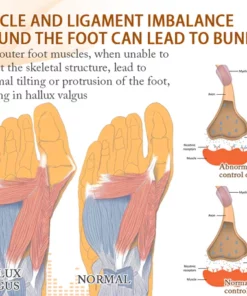Fivfivgo™ Ferninfrarot-Fußkorrektur-Therapiesocken