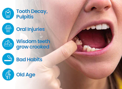 Fivfivgo™ Glory Smile Provisorisches Zahnbildhauer-Reparaturset