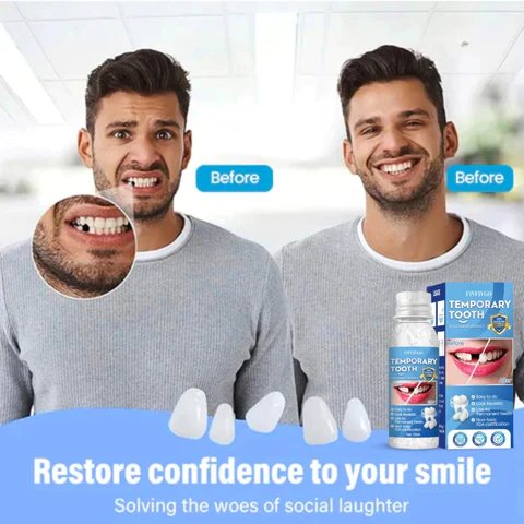 Fivfivgo™ Glory Smile Provisorisches Zahnbildhauer-Reparaturset