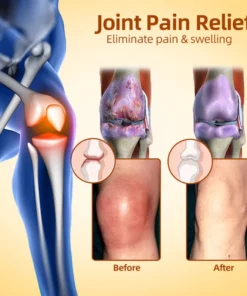Fivfivgo™ Kanadisches Bienengift lindert Knochenschmerzen und repariert Knochenverletzungen Gel