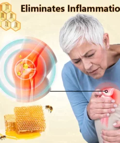 Fivfivgo™ Kanadisches Bienengift lindert Knochenschmerzen und repariert Knochenverletzungen Gel