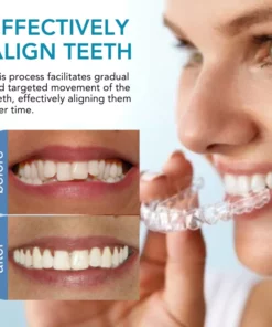 Fivfivgo™ Kieferorthopädie Begradigung Guard