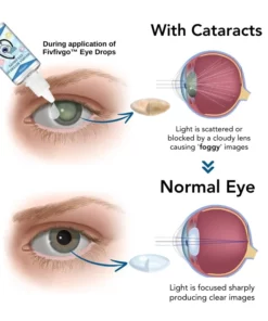 Fivfivgo™ Myopie Reversal Augentropfen