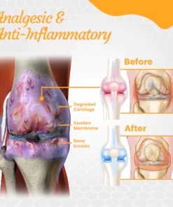 Fivfivgo™ NZ Bienengift Behandlungsgel