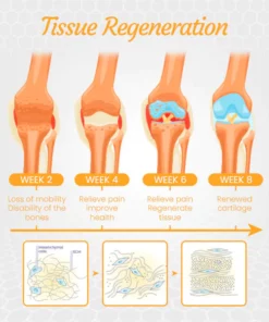 Fivfivgo™ NZ Bienengift Behandlungsgel