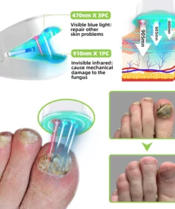 Fivfivgo™ Nagelpilz-Lasertherapiegerät Max