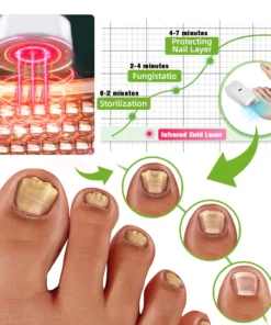 Fivfivgo™ Nagelpilz-Lasertherapiegerät Max