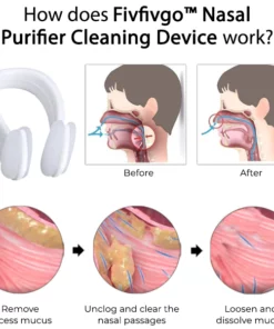 Fivfivgo™ Nasensauger-Reinigungsgerät