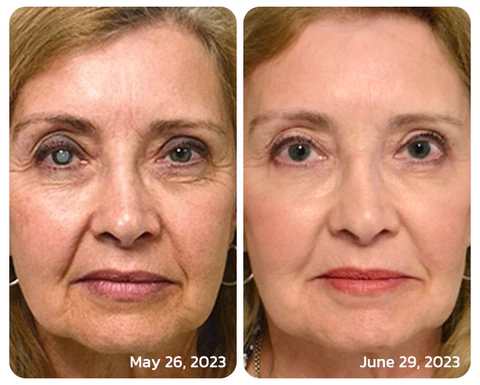 Fivfivgo™ OphthalPro Gerät zur Verbesserung der Sehkraft