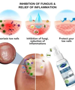 Fivfivgo™ Psoriasis-Behandlungsspray