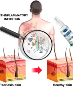 Fivfivgo™ Psoriasis Treatment Spray