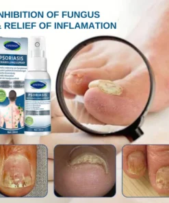 Fivfivgo™ Psoriasis Treatment Spray