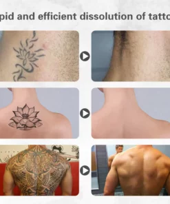 Fivfivgo™ Tattoo-Auflösungsgel