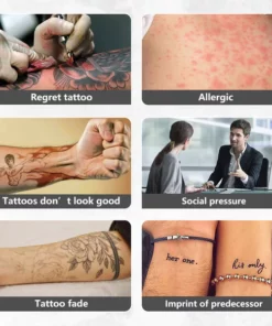 Fivfivgo™ Tattoo-Auflösungsgel