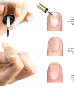 Fivfivgo™ VitaE Peeling-Nagelserum