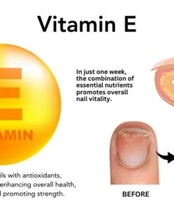 Fivfivgo™ VitaE Peeling-Nagelserum