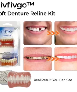 Fivfivgo™ Weichbleibende Prothese Reline Kit