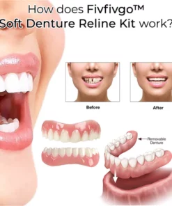Fivfivgo™ Weichbleibende Prothese Reline Kit