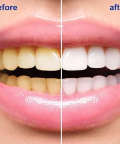 Fivfivgo™ Zahnweiß-Pulver