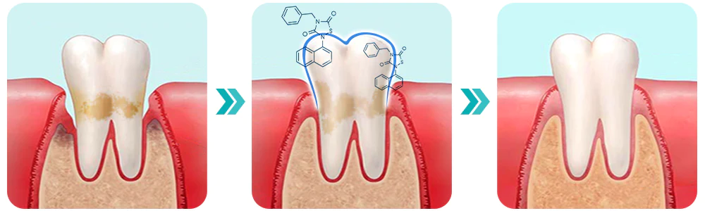 Furzero™ SMARTSmile Oral Mouthwash