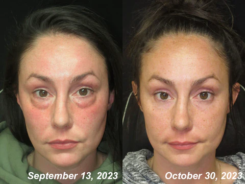 Furzero™ Deep Reviving Peptide Lifting Eye Gel