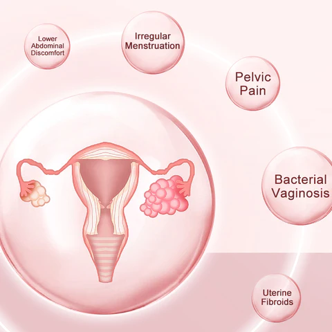 Furzero™ Instant Itch Relief & Natural Detox & Firming Repair & Pink and Tender Natural Capsules