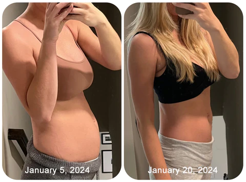 Furzero™ Instant Itch Relief & Natural Detox & Firming Repair & Pink and Tender Natural Capsules