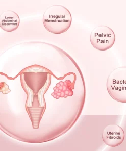 Furzero™ Natural Repair Vaginal Capsules