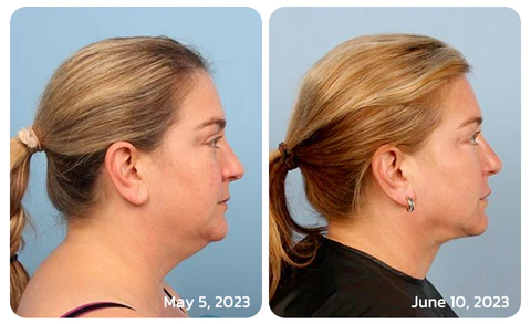 Futusly™ Trianglation De Cartien Osmium Earring